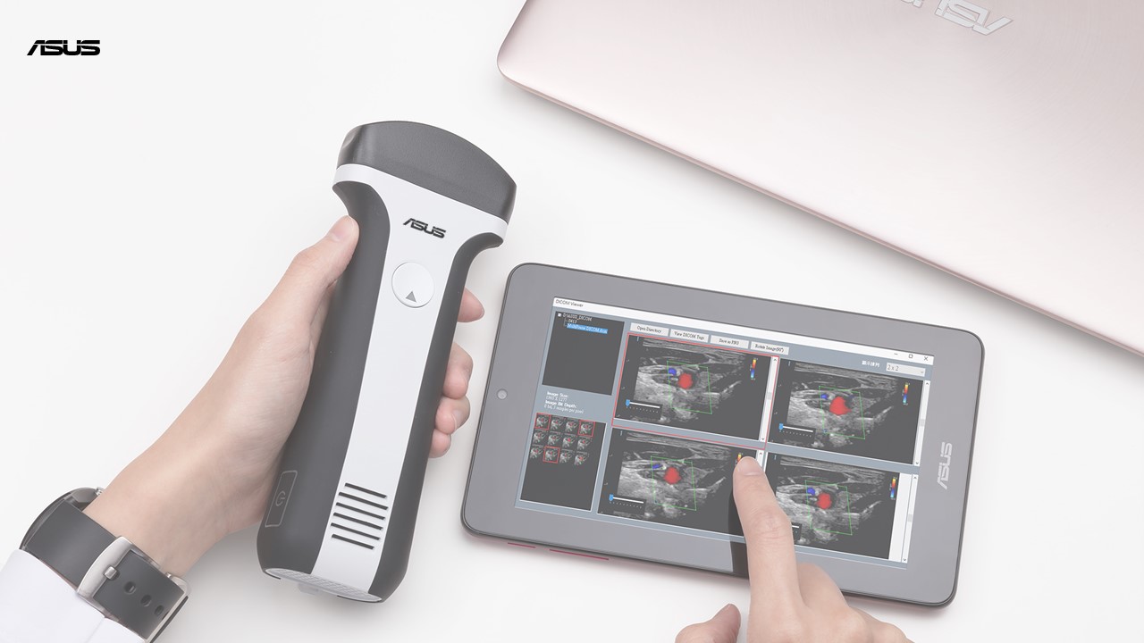 ASUS Handheld Ultrasound LU710 Series